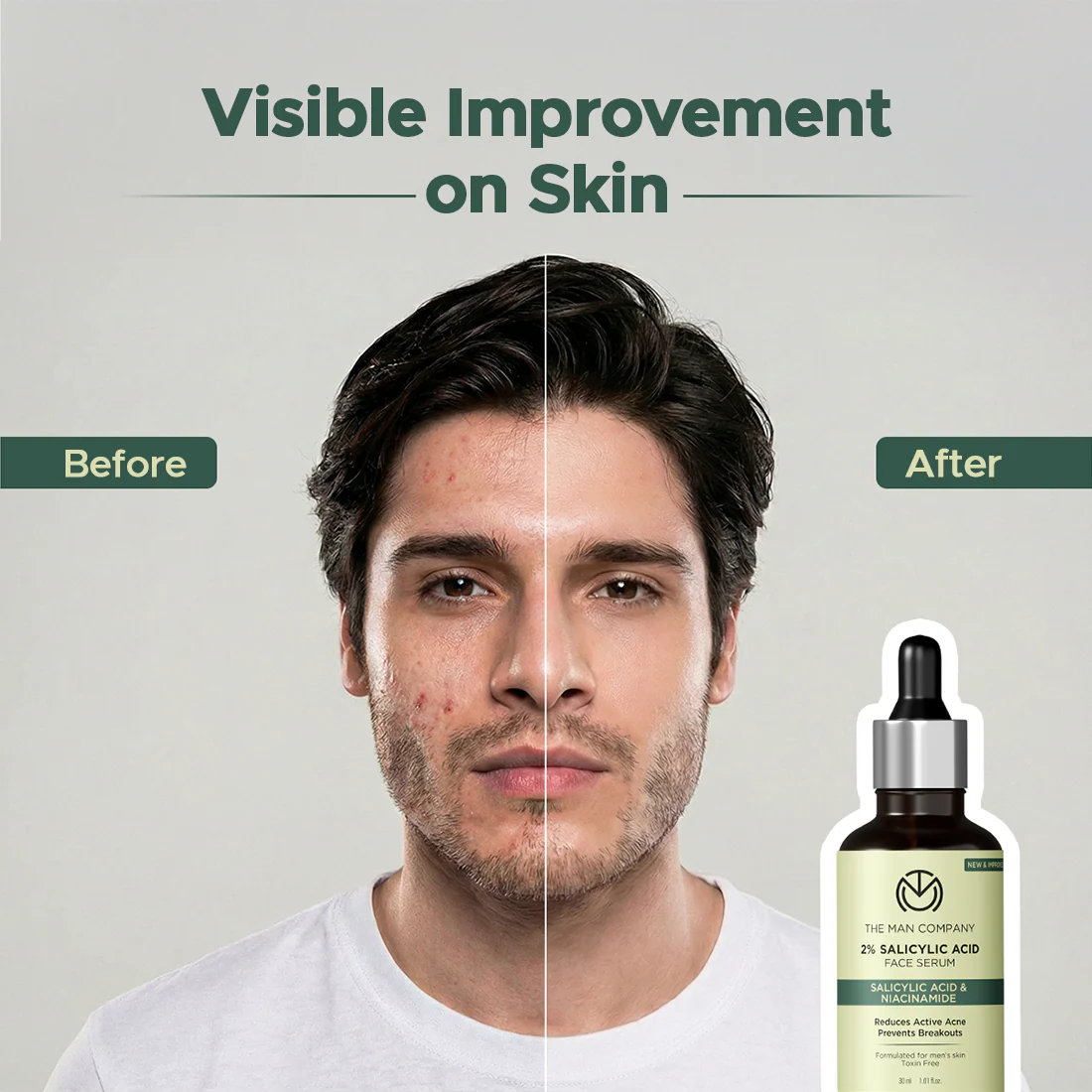 2% Salicylic Acid | Anti-Acne Face Serum - Image 7