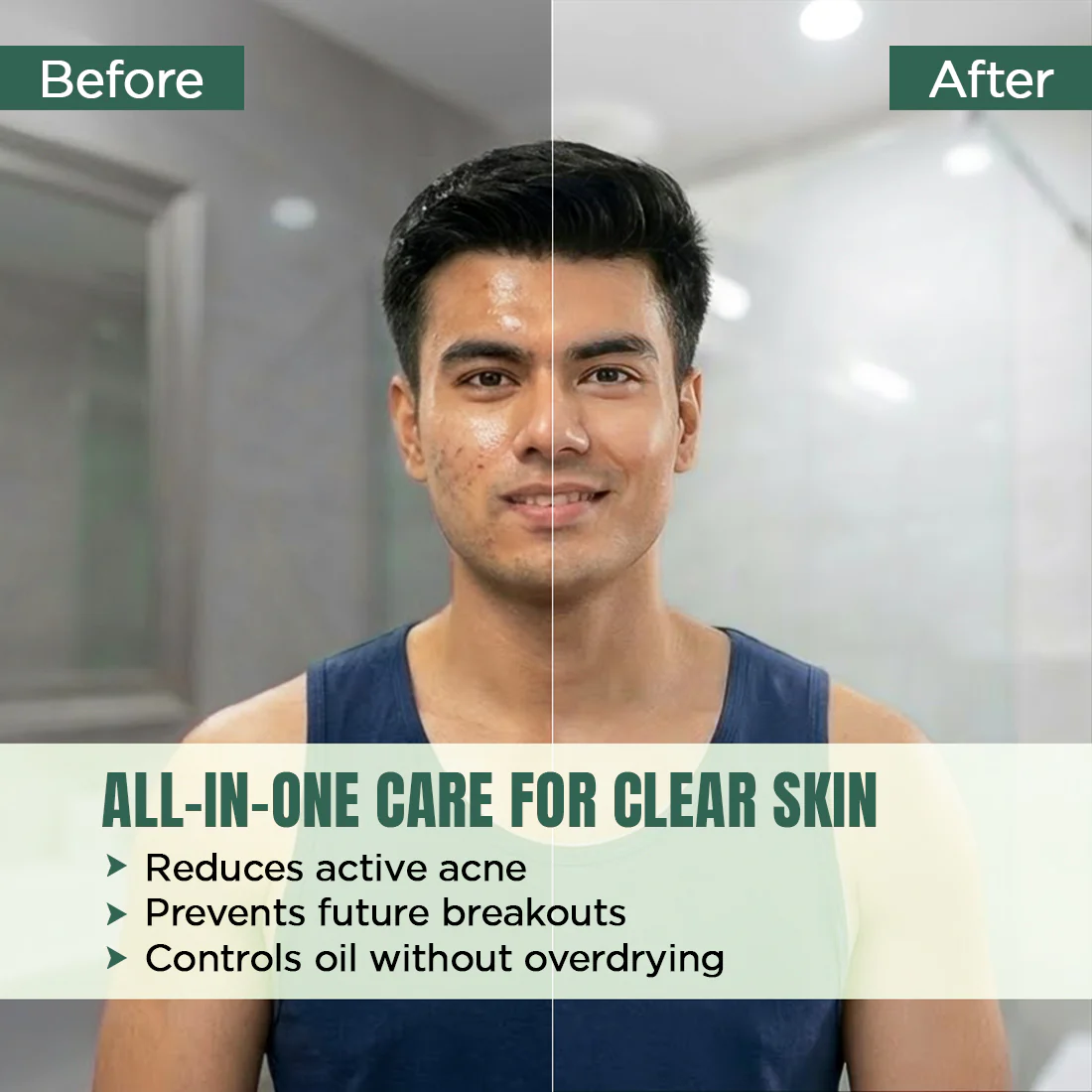 Acne Clear Combo - Image 4