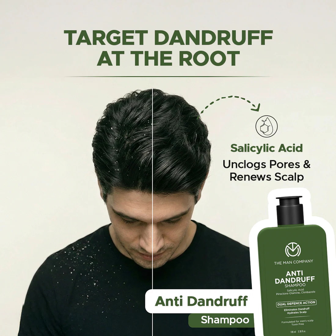 Anti-Dandruff Shampoo for Men | Salicylic Acid | Flake Control from First Wash (100ml) - Image 2