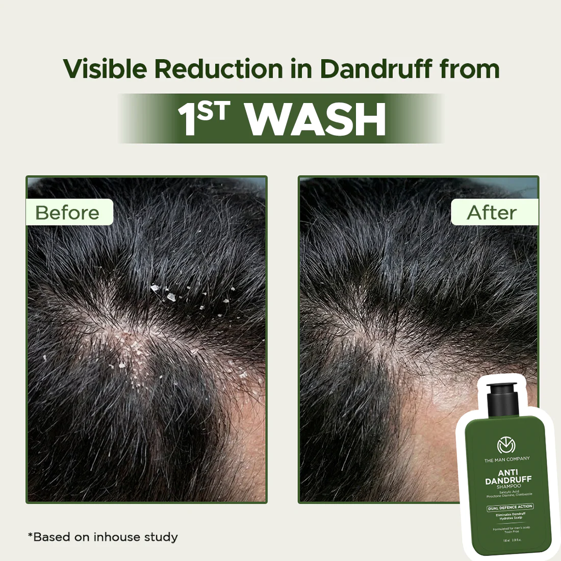 Anti-Dandruff Shampoo for Men | Salicylic Acid | Flake Control from First Wash (100ml) - Image 3