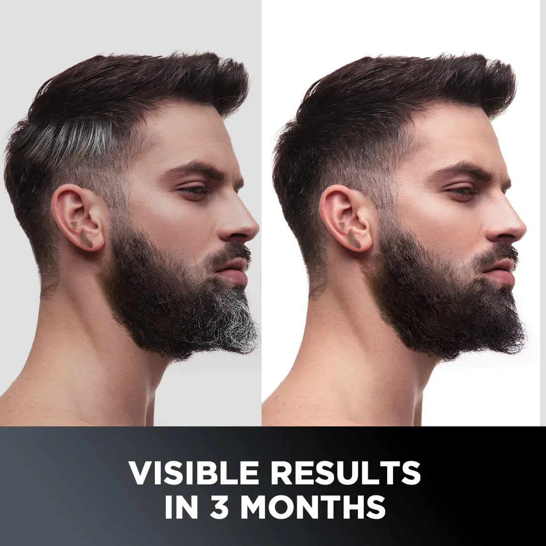 Anti-Graying Hair & Beard Cream | Arcolys & Bhringraj - Image 2