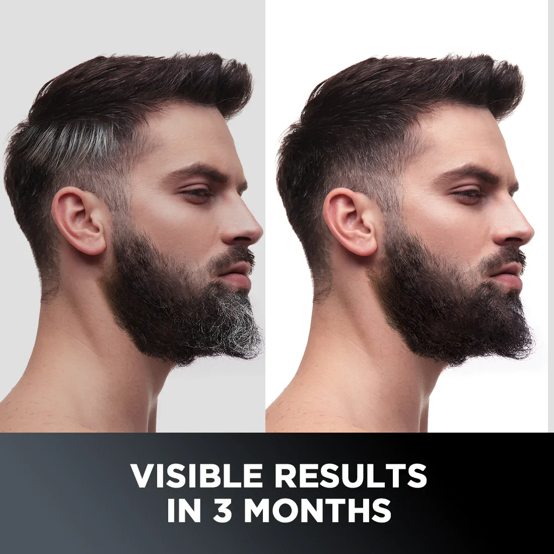 Anti-Graying Hair & Beard Serum | Arcolys & Bhringraj - Image 2
