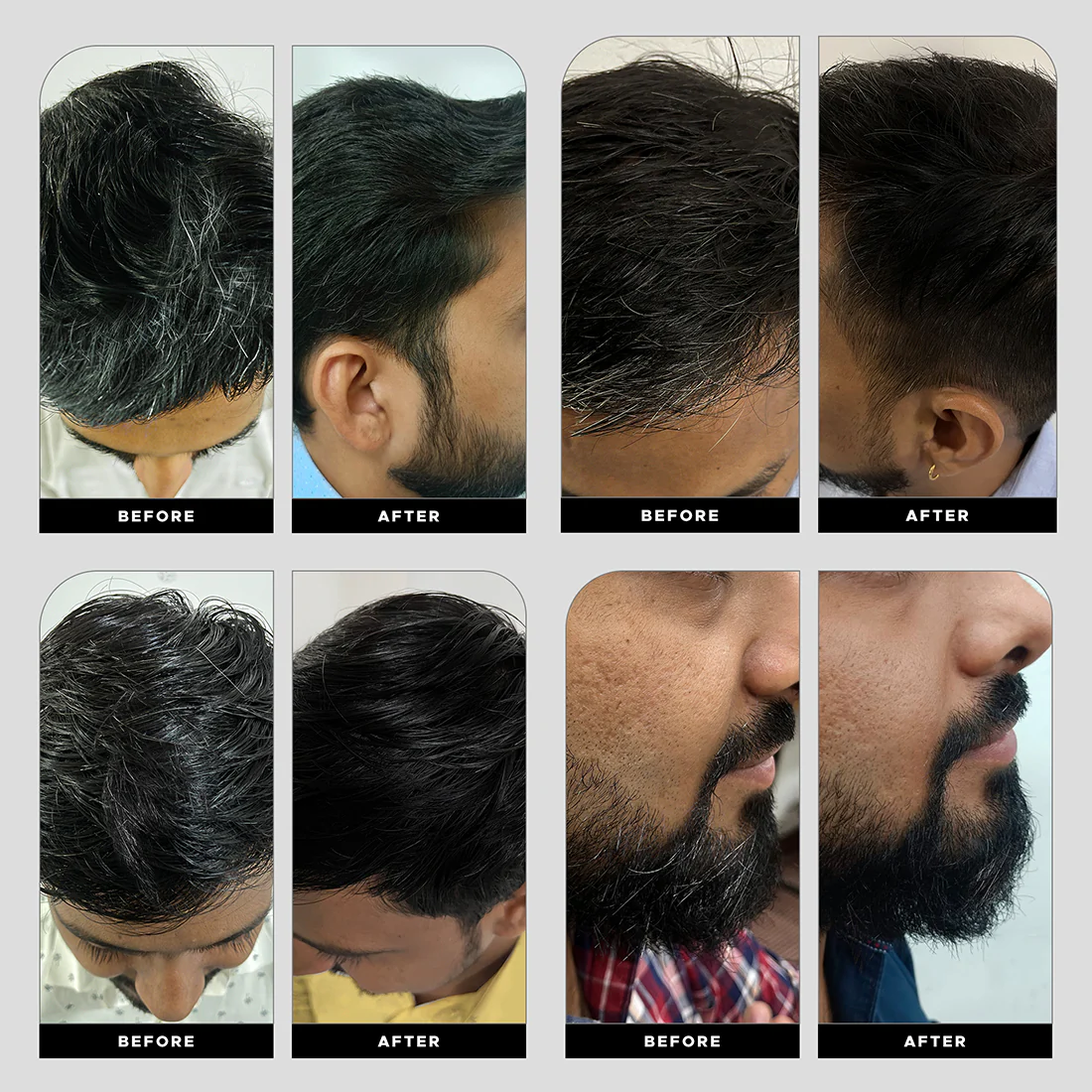 Anti-Graying Shampoo & Conditioner - Image 12