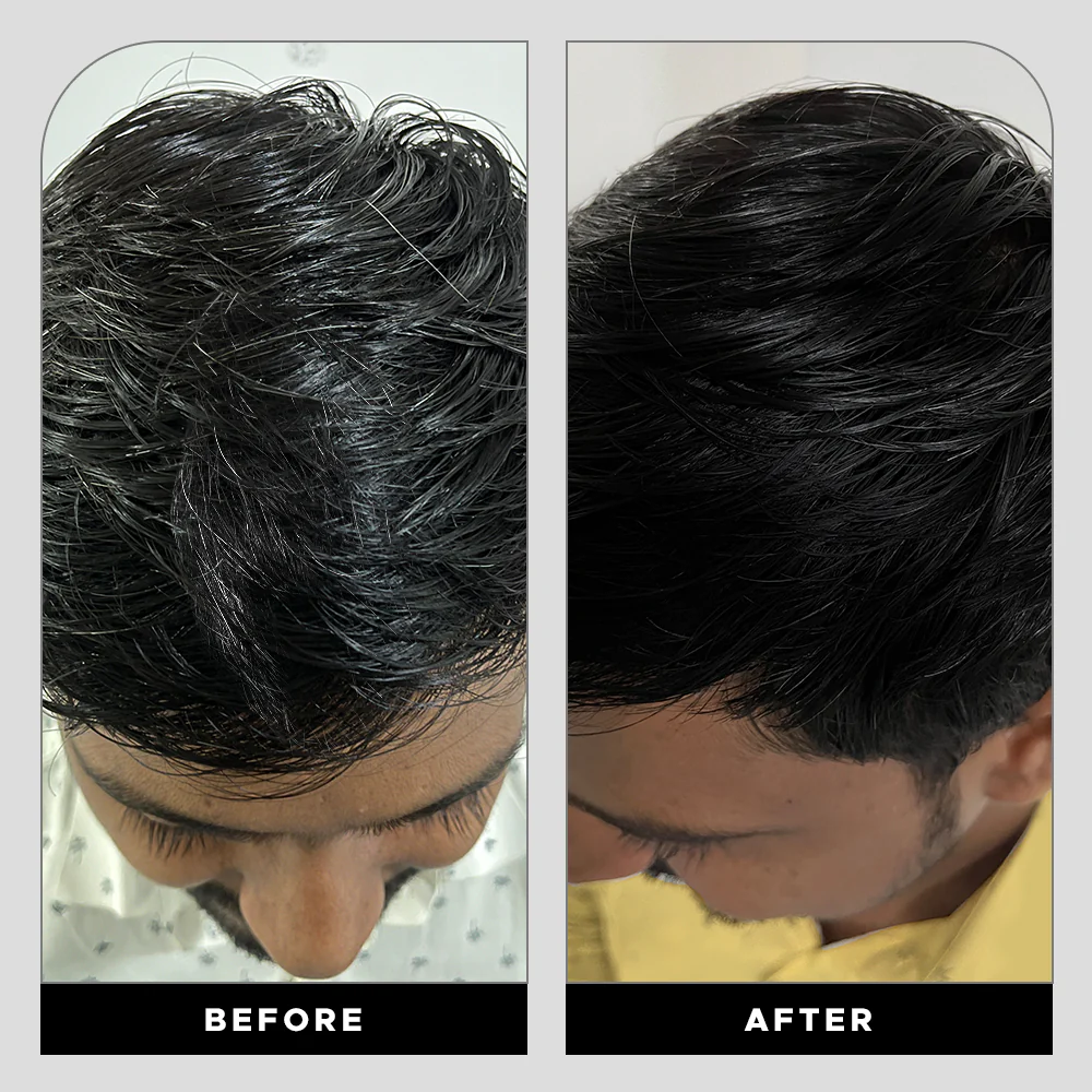 Anti-Graying Shampoo & Conditioner - Image 13