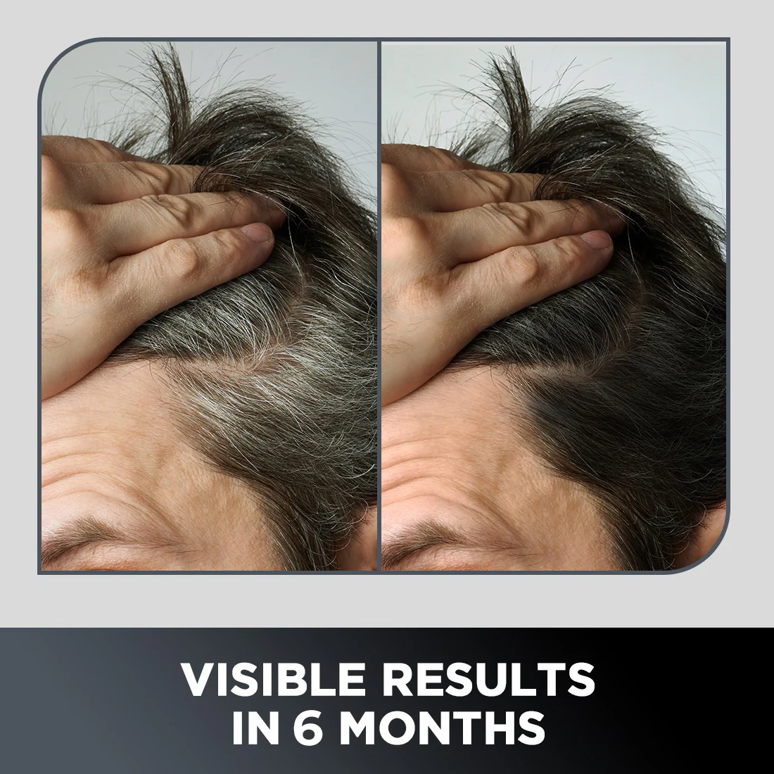 Anti-Graying Shampoo & Conditioner - Image 4