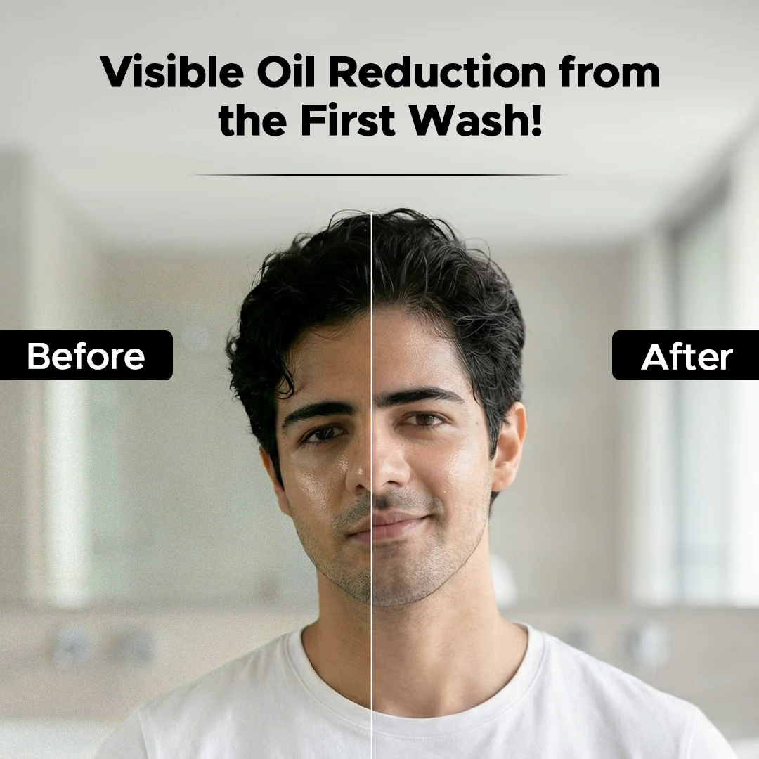 Charcoal Face Wash for Men – Charcoal & Niacinamide | Deep Cleansing & Oil Control - Image 8