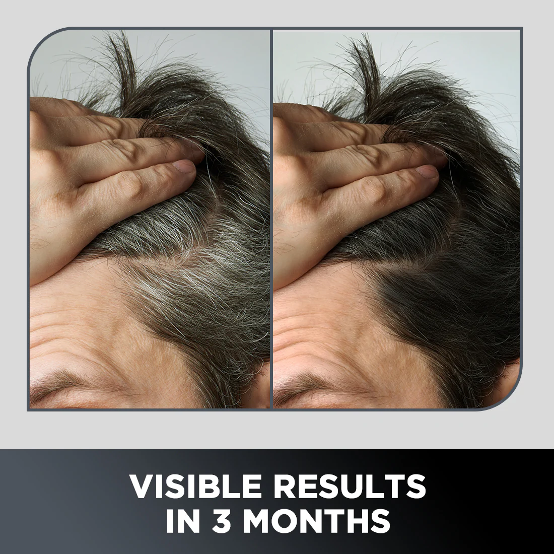 Grey Hair Remedy Kit - Image 3