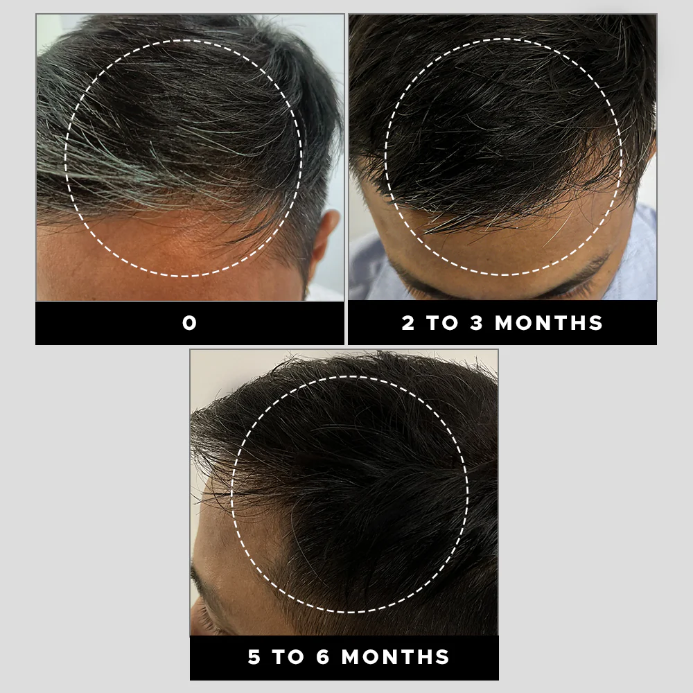 Grey Hair Remedy Kit - Image 2