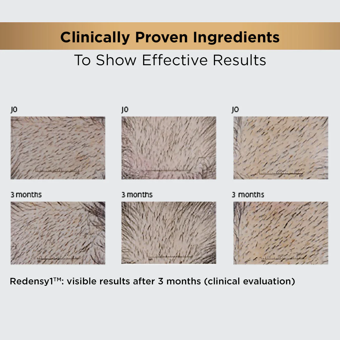 Hair Growth Regime Kit - Image 18