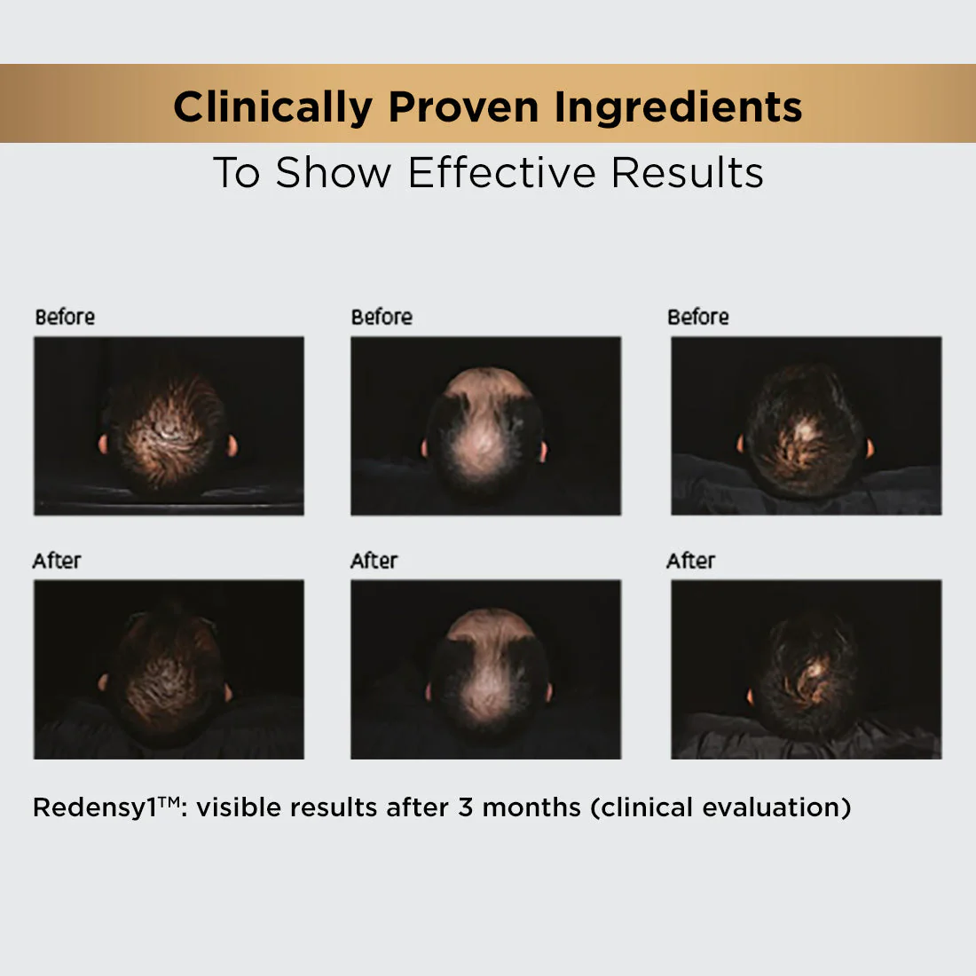 Hair Growth Regime Kit - Image 19