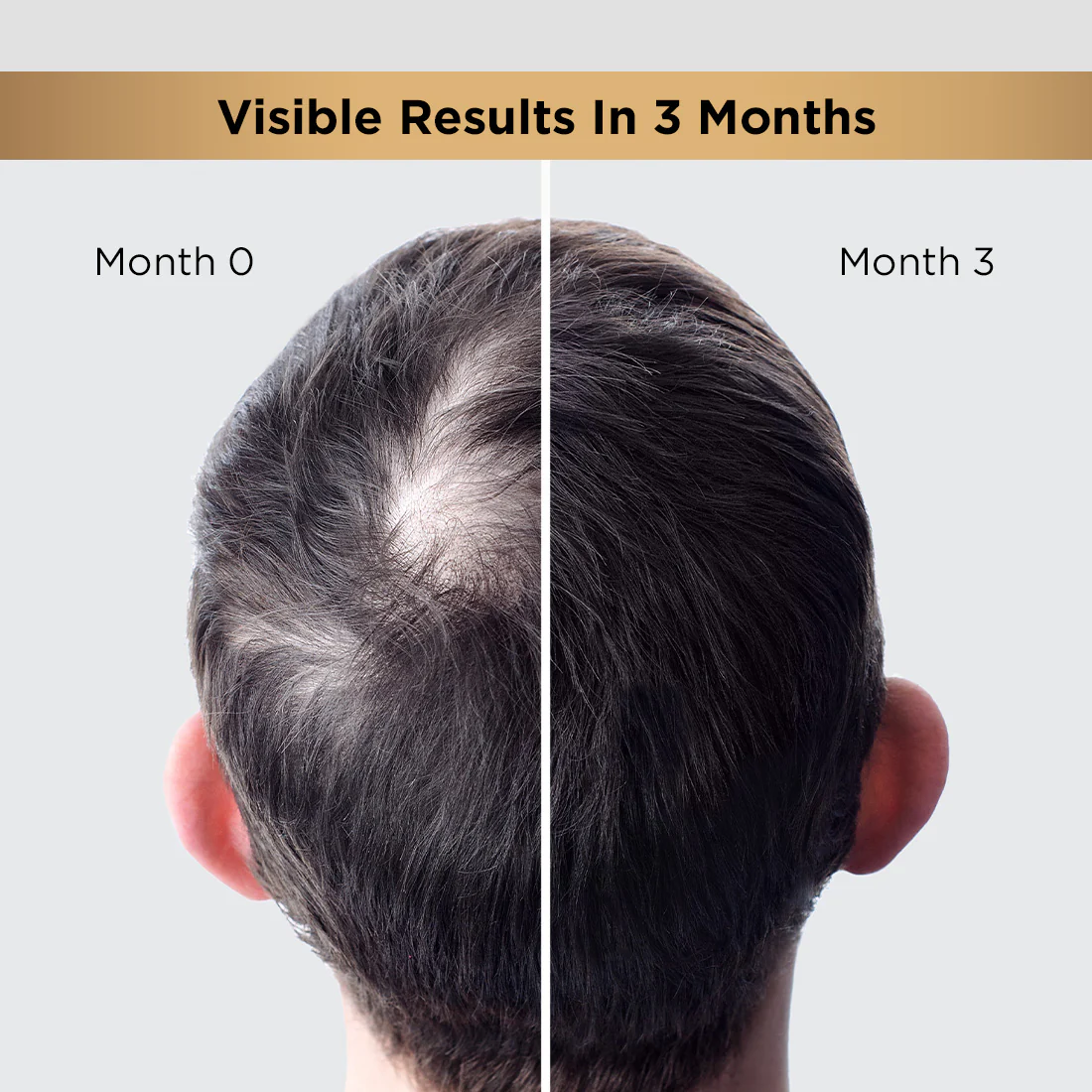 Hair Growth Regime Kit - Image 2