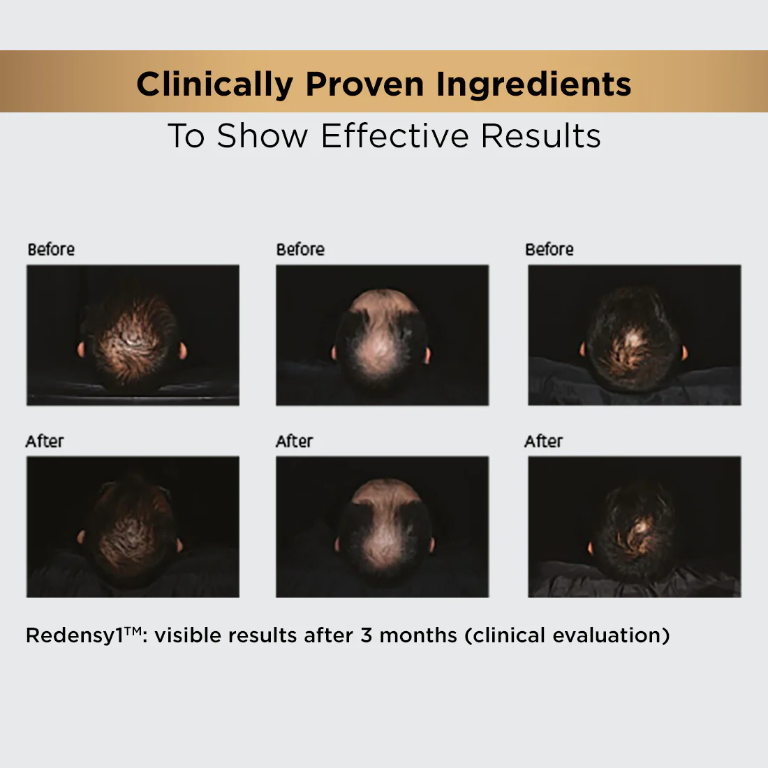 Hair Growth Regime Kit - Image 6