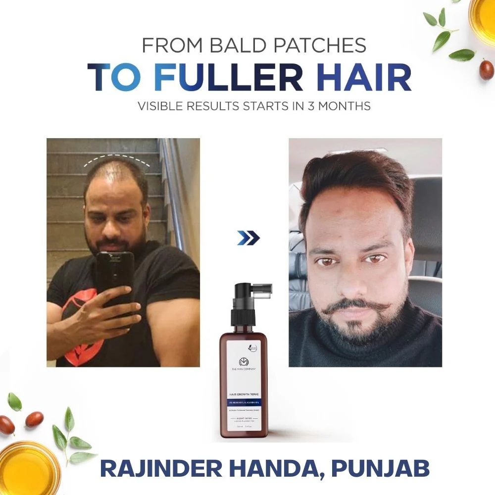 Hair Growth Tonic | 3% Redensyl & Jojoba Oil - Image 5