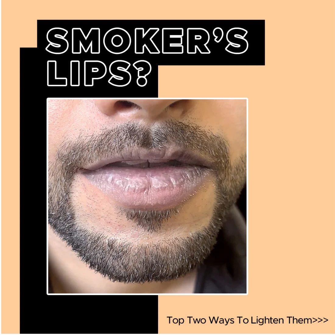 Lip Lightening Regime - Image 6